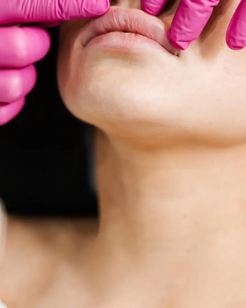 Fillers The Modern Magic for Rejuvenation and Enhancing Beauty 
الفيلر 2025